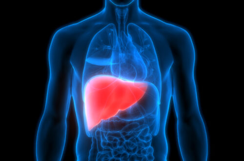 Reduce Fatty Liver Quickly