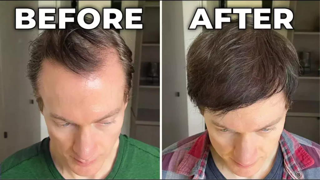 Hair Growth Naturally