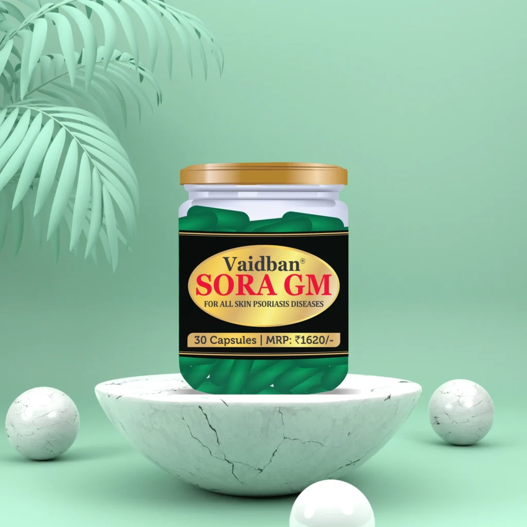 How to Cure Psoriasis